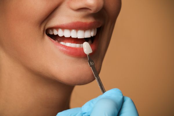 How Dentists Can Make Dental Veneers Look More Natural