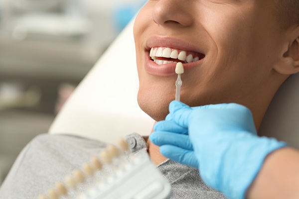 Benefits Of Porcelain Veneers