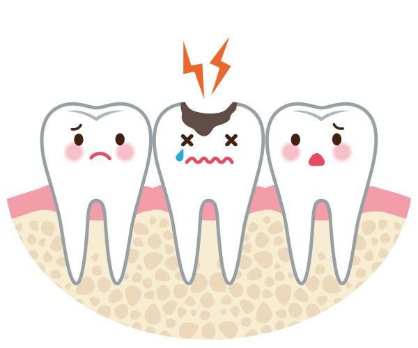 Tips For Reversing Tooth Decay